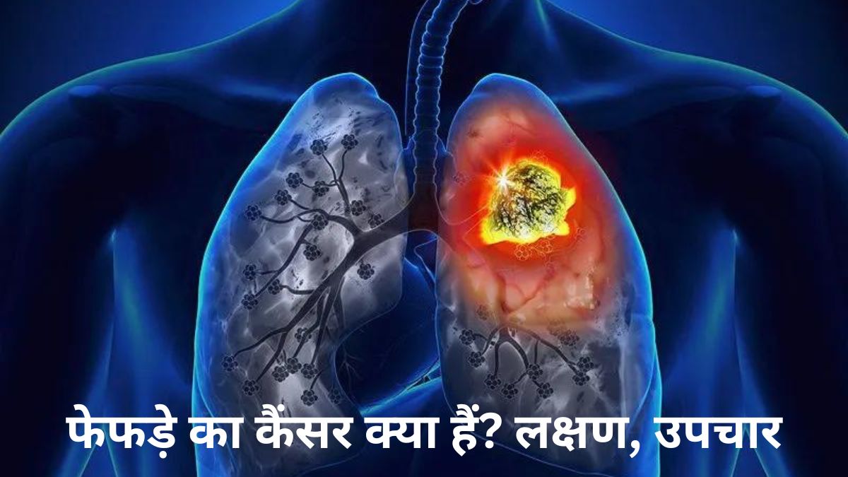 फेफड़े का कैंसर क्या हैं? लक्षण, उपचार | Lung Cancer In Hindi